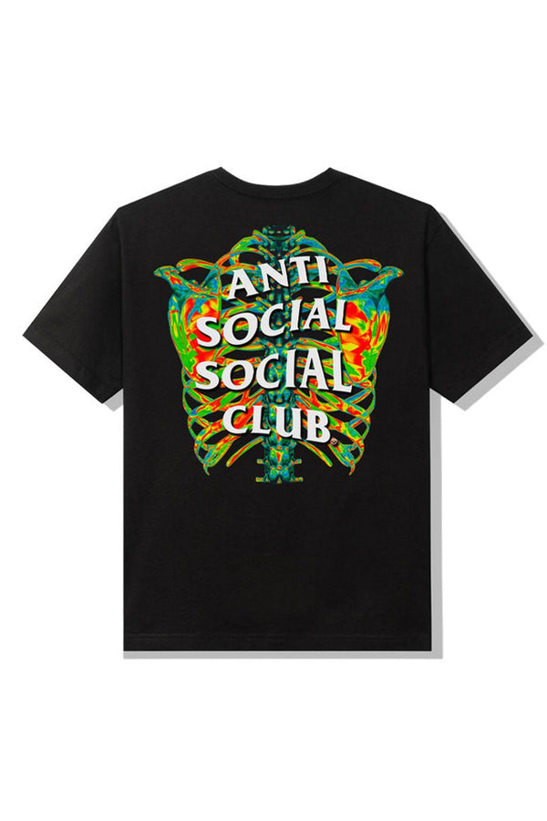 Anti Social Social Club Blow To The Chest Tee Black